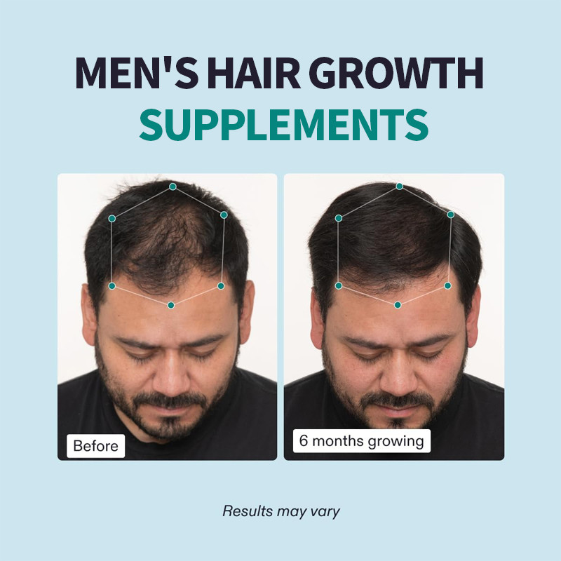 OEM Pria Tumbuh Rambut Suplemen terlihat lebih tebal Rambut Dan Penutup Kepala Pria Capsules Rambut