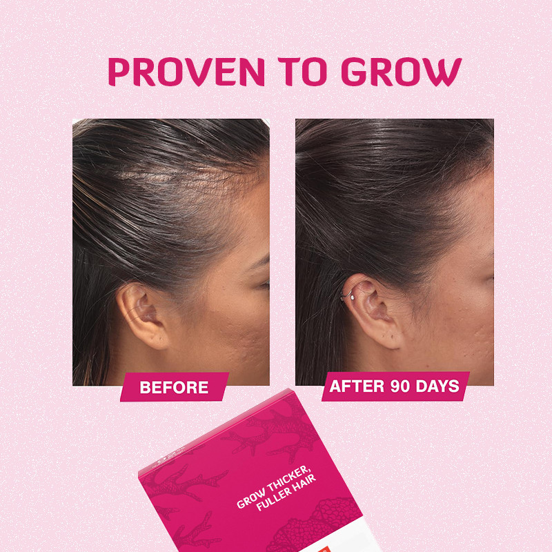 Tablet Pertumbuhan Rambut 120mcg Biotin Produk Pertumbuhan Rambut Untuk Pertumbuhan Rambut