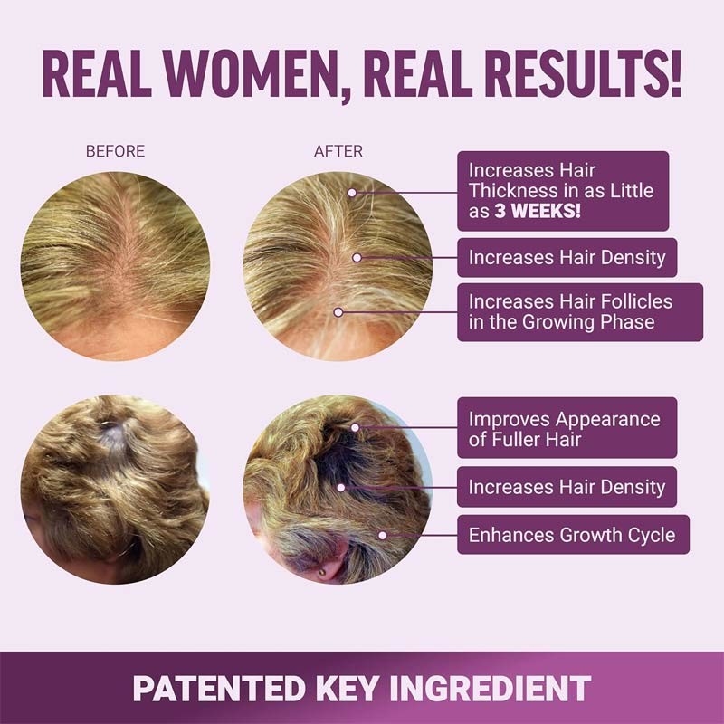 Pengcepat Pertumbuhan Rambut Permen karet untuk pertumbuhan rambut untuk kekuatan rambut