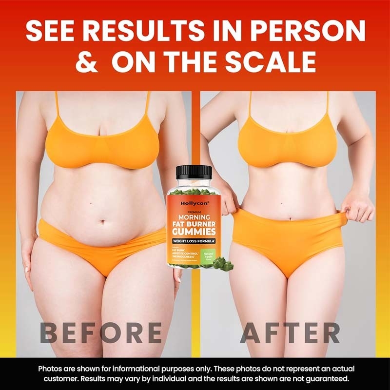 2024 Pabrik Hot Selling Morning Fat Burner Gummies Pengelolaan Berat Badan untuk Wanita & Pria