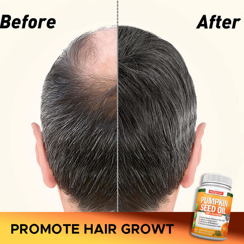 Minyak Biji labu Pabrik Softgels Rambut Prostat Kesehatan sendi Omega-3 Asam lemak esensial Suplemen