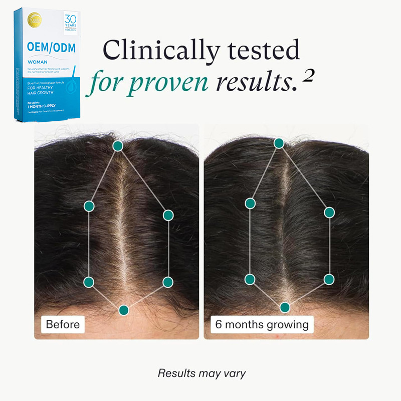 OEM Pertumbuhan Rambut Makanan Suplemen Pertumbuhan Rambut Tablet Untuk Pertumbuhan Rambut Alam yang Kuat