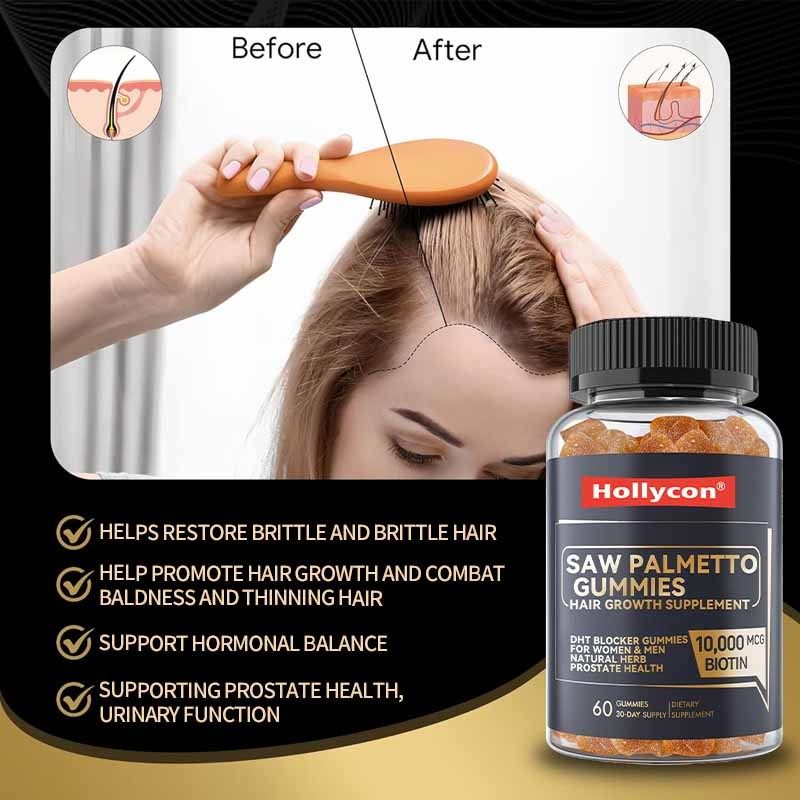Suplemen Pertumbuhan Rambut Pabrik untuk Wanita & Pria DHT Blocker Gummies Mendukung Keseimbangan Hormonal Kesehatan Prostat Saw Palmetto Gummies