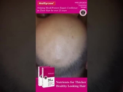 Tablet Pertumbuhan Rambut Merah